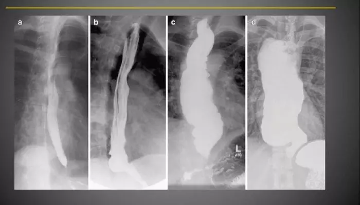 Диагностика заболеваний желудка