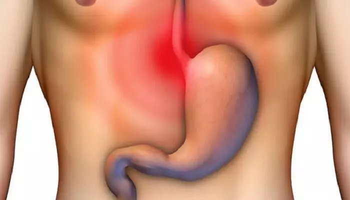 Желудок в теле человека Желудок в теле человека