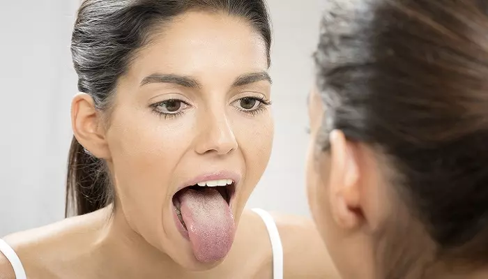 Можно ли определить гастрит по языку Можно ли определить гастрит по языку